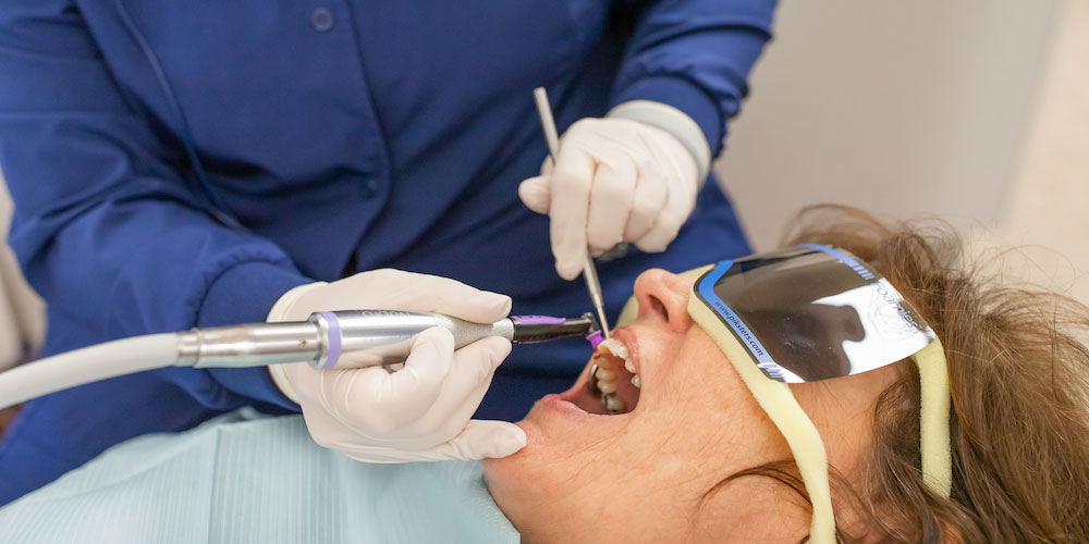 professional-cleaning-columbia-dental-group